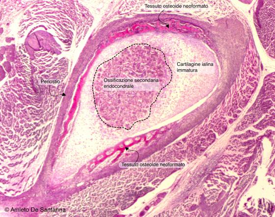 Figura C107. Femore (epifisi) di feto umano